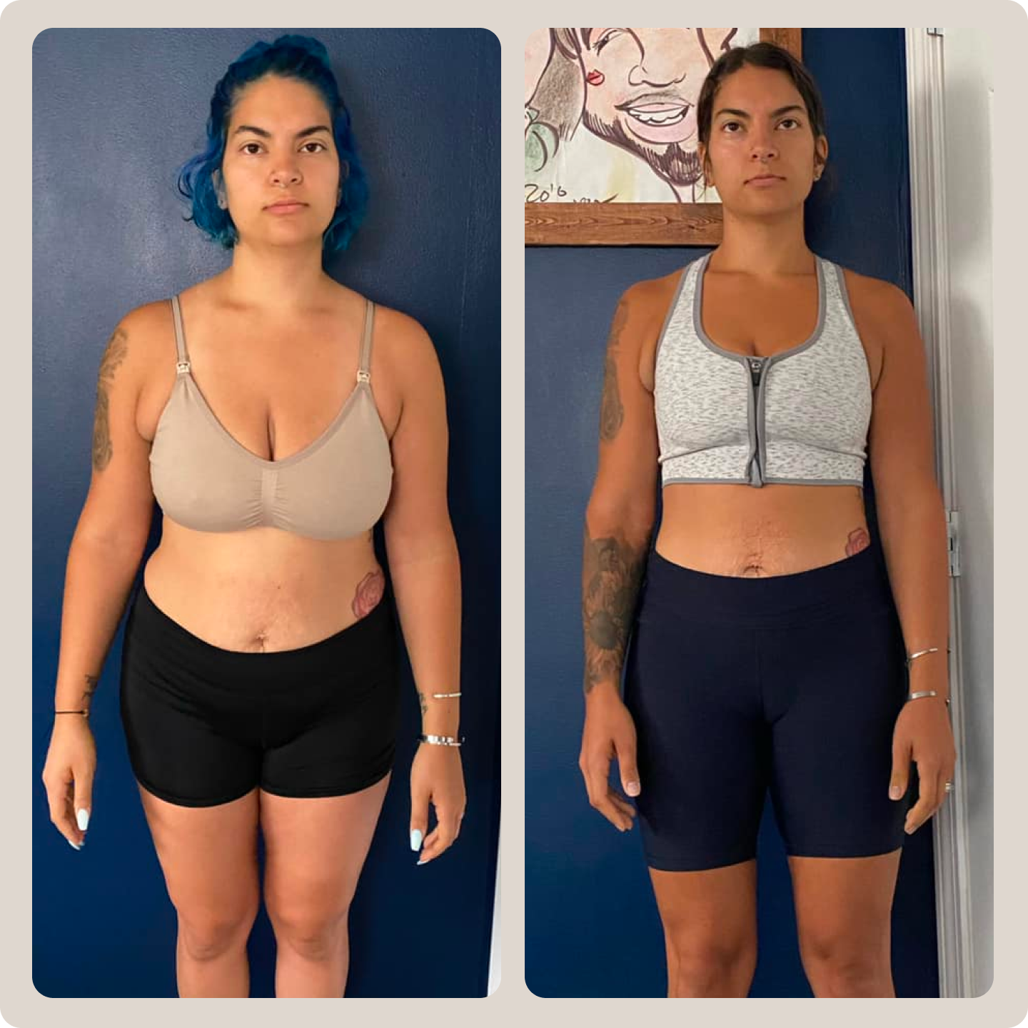 Brittany before and after